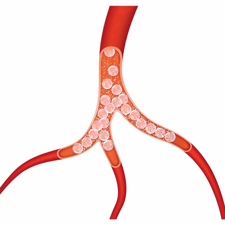 ekobi hyperechoic biodegradable microspheres illustration